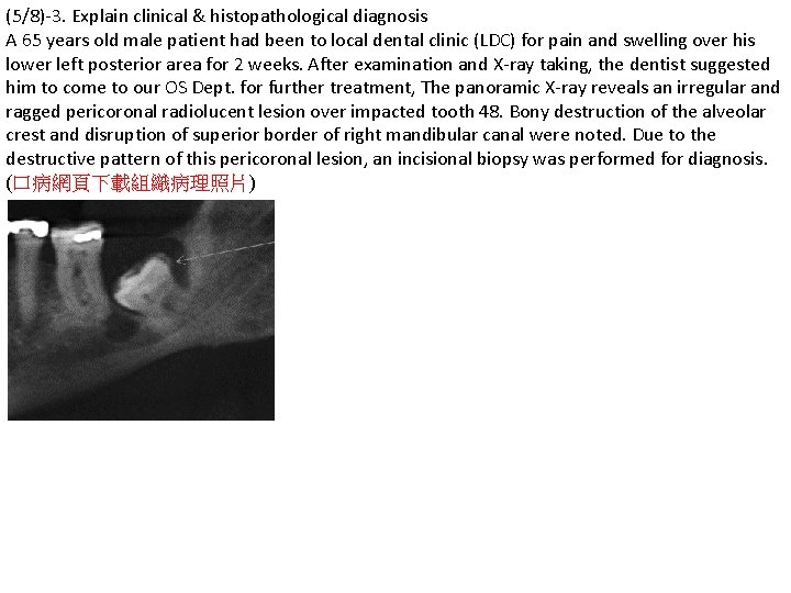 (5/8)-3. Explain clinical & histopathological diagnosis A 65 years old male patient had been