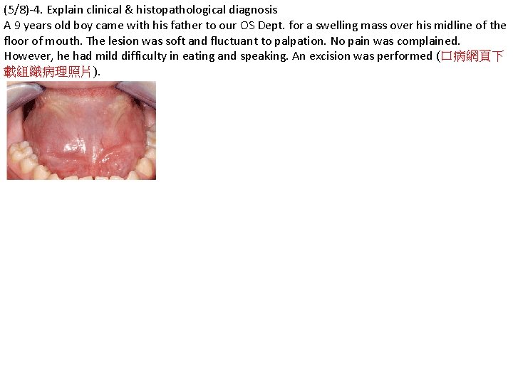 (5/8)-4. Explain clinical & histopathological diagnosis A 9 years old boy came with his
