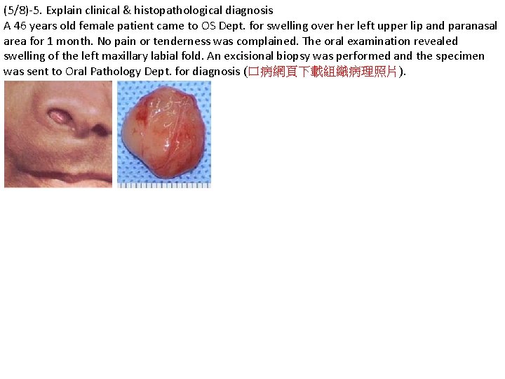 (5/8)-5. Explain clinical & histopathological diagnosis A 46 years old female patient came to