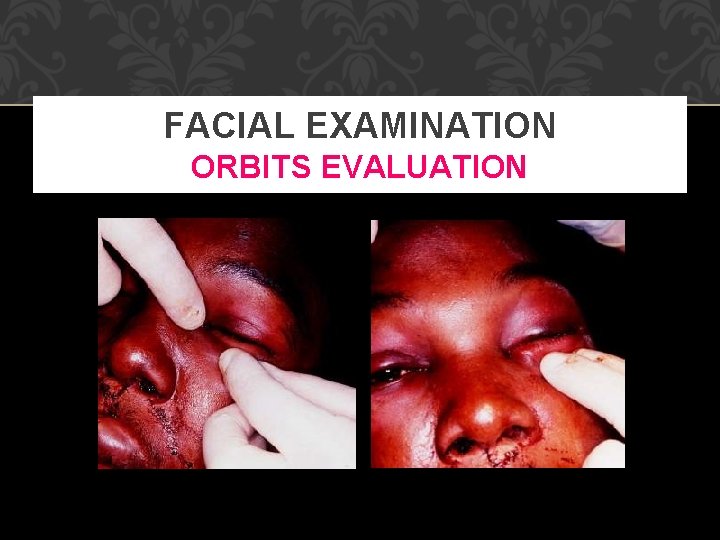 FACIAL EXAMINATION ORBITS EVALUATION 