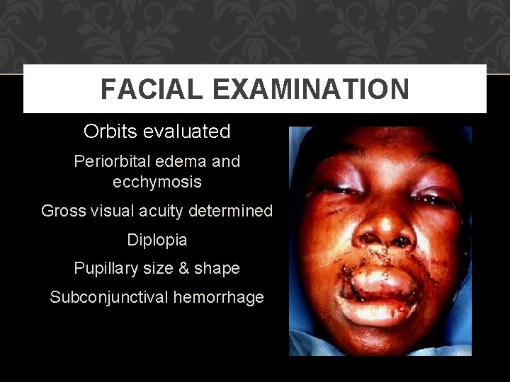 FACIAL EXAMINATION Orbits evaluated Periorbital edema and ecchymosis Gross visual acuity determined Diplopia Pupillary