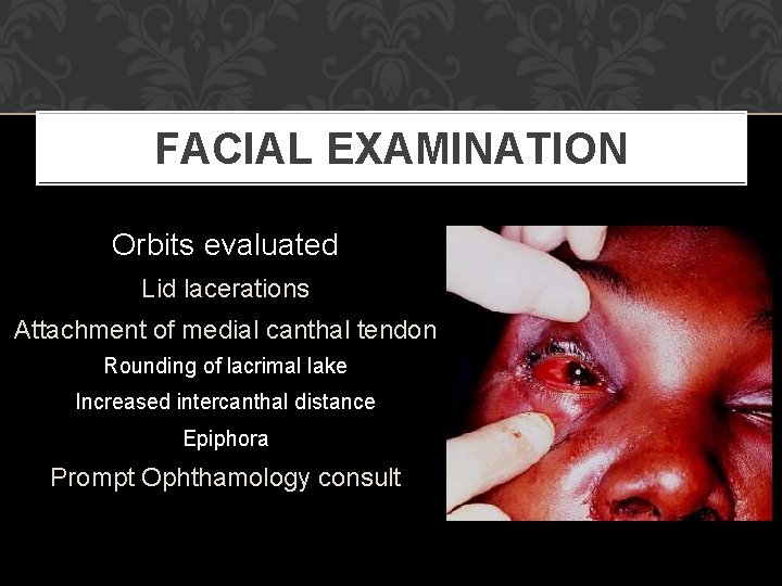 FACIAL EXAMINATION Orbits evaluated Lid lacerations Attachment of medial canthal tendon Rounding of lacrimal