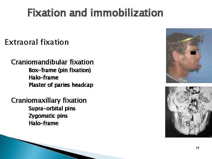 Fixation and immobilization Extraoral fixation Craniomandibular fixation Box-frame (pin fixation) Halo-frame Plaster of paries