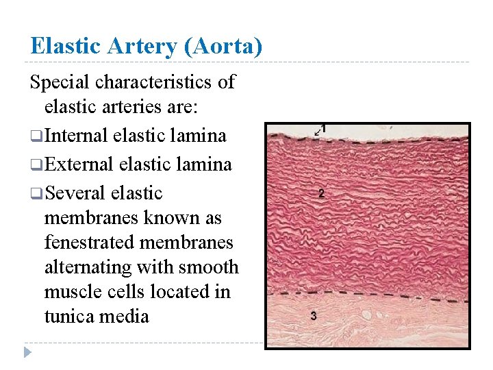 Elastic Artery (Aorta) Special characteristics of elastic arteries are: q Internal elastic lamina q