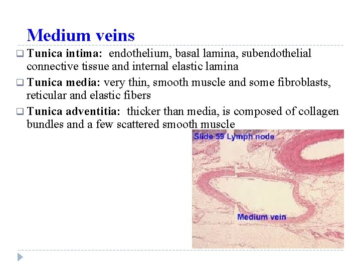 Medium veins q Tunica intima: endothelium, basal lamina, subendothelial connective tissue and internal elastic