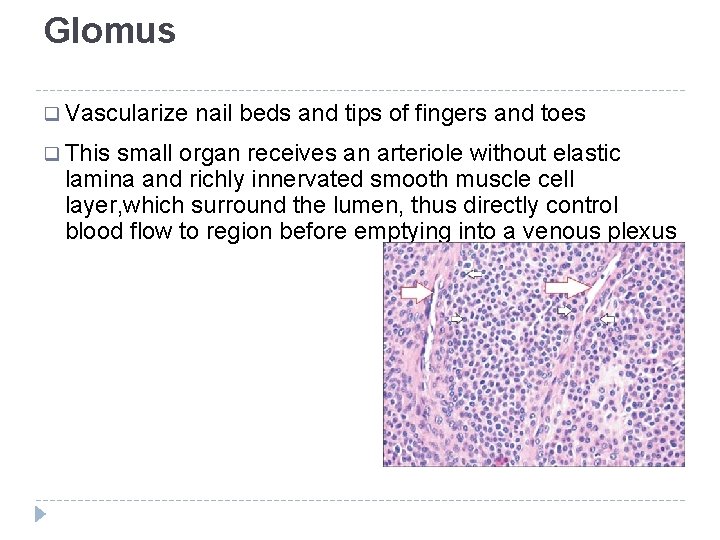 Glomus q Vascularize q This nail beds and tips of fingers and toes small