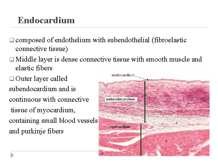 Endocardium q composed of endothelium with subendothelial (fibroelastic connective tissue) q Middle layer is