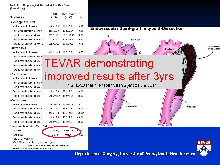 TEVAR demonstrating improved results after 3 yrs INSTEAD trial-Nienaber Veith Symposium 2011 Department of TEVAR demonstrating improved results after 3 yrs INSTEAD trial-Nienaber Veith Symposium 2011 Department of