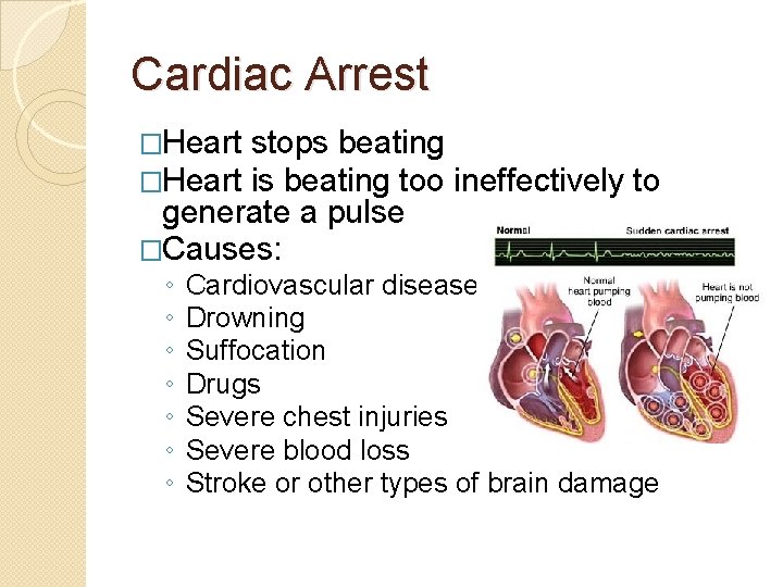 Cardiac Arrest �Heart stops beating is beating too ineffectively to generate a pulse �Causes: