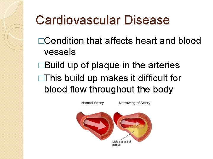 Cardiovascular Disease �Condition that affects heart and blood vessels �Build up of plaque in