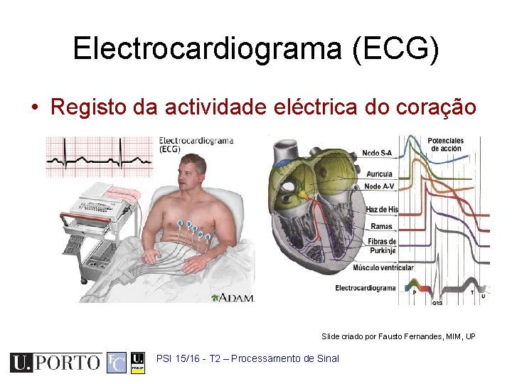 Electrocardiograma (ECG) • Registo da actividade eléctrica do coração Slide criado por Fausto Fernandes,