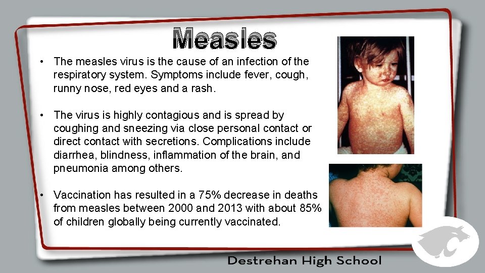 Measles • The measles virus is the cause of an infection of the respiratory