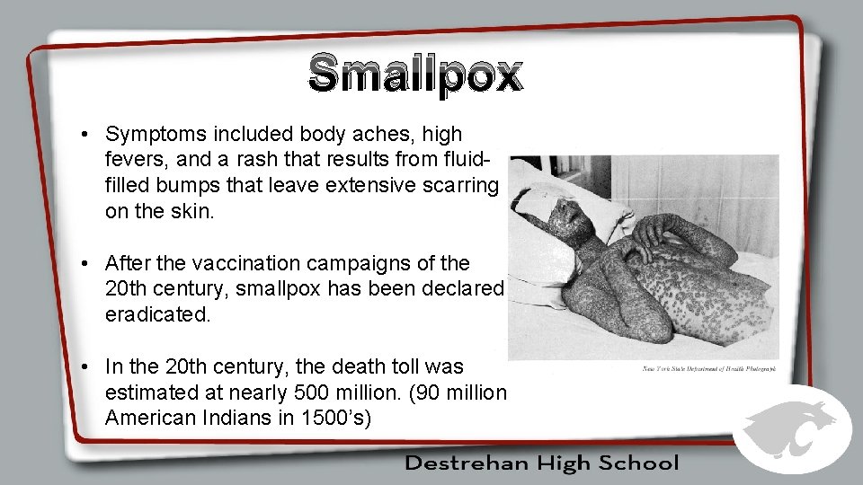 Smallpox • Symptoms included body aches, high fevers, and a rash that results from