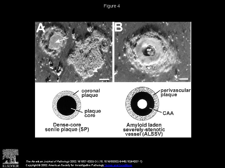 Figure 4 The American Journal of Pathology 2002 161507 -520 DOI: (10. 1016/S 0002