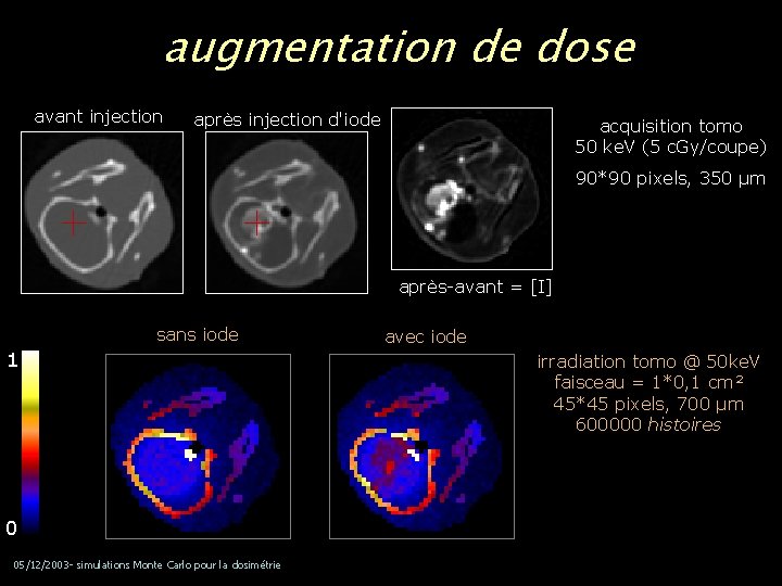 augmentation de dose avant injection après injection d'iode acquisition tomo 50 ke. V (5