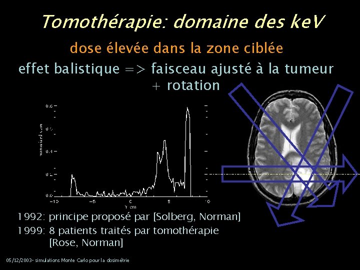 Tomothérapie: domaine des ke. V dose élevée dans la zone ciblée effet balistique =>