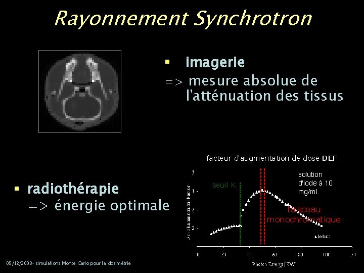 Rayonnement Synchrotron imagerie => mesure absolue de l'atténuation des tissus § facteur d'augmentation de