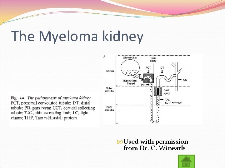 The Myeloma kidney Used with permission from Dr. C. Winearls 