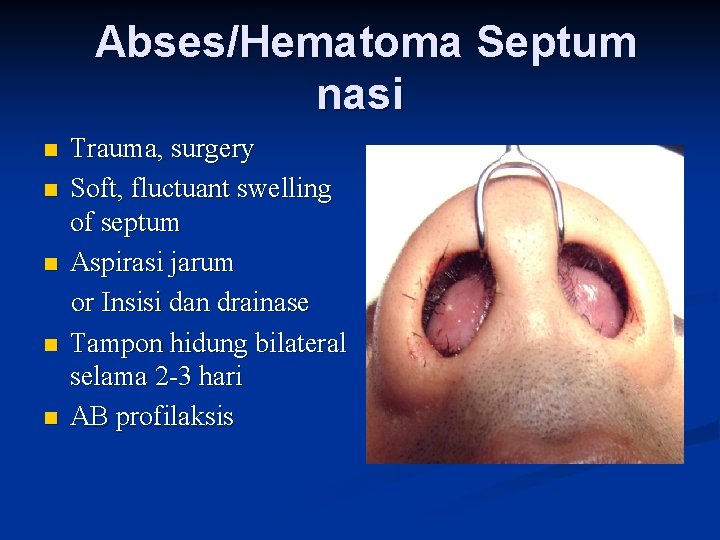 Abses/Hematoma Septum nasi n n n Trauma, surgery Soft, fluctuant swelling of septum Aspirasi