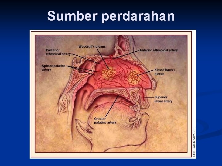 Sumber perdarahan 