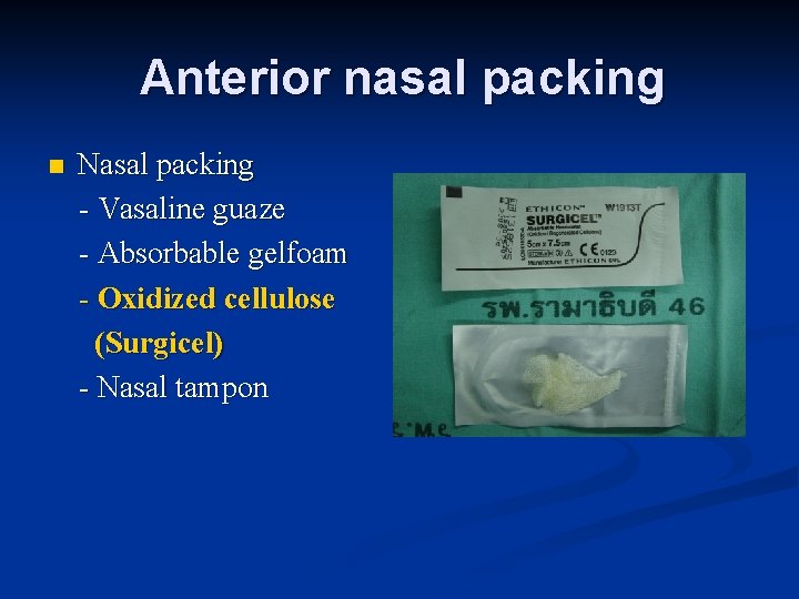 Anterior nasal packing n Nasal packing - Vasaline guaze - Absorbable gelfoam - Oxidized