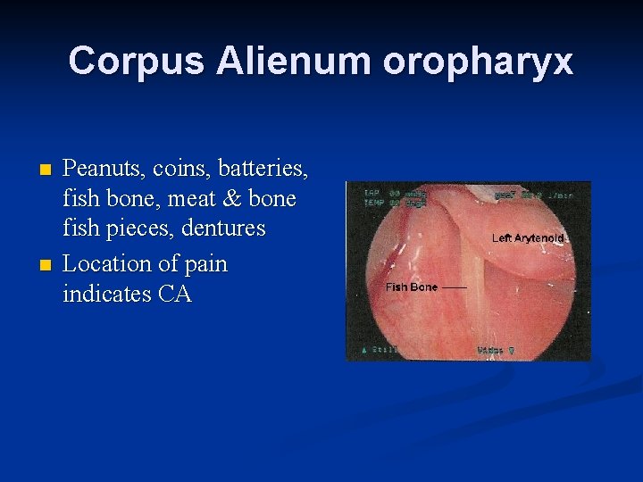 Corpus Alienum oropharyx n n Peanuts, coins, batteries, fish bone, meat & bone fish