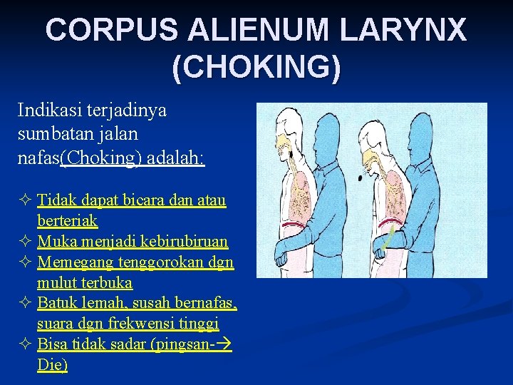 CORPUS ALIENUM LARYNX (CHOKING) Indikasi terjadinya sumbatan jalan nafas(Choking) adalah: ² Tidak dapat bicara