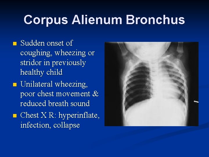 Corpus Alienum Bronchus n n n Sudden onset of coughing, wheezing or stridor in