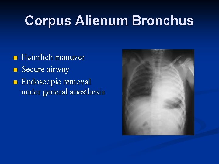 Corpus Alienum Bronchus n n n Heimlich manuver Secure airway Endoscopic removal under general