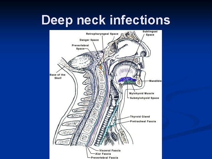 Deep neck infections 