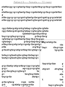 Patient 6 –-- Female –-- 72 years atattacggcgccgtaatgctagccgatattagcgctagccgatattac g atattacggcgccgtaatgctagccgatatatgcgctagccgatattac g attacggcgcgccgcgatcgtaatgctacgatcggcgcatatat attacggcgcgccgcgatcgtacgatcggcgcatatat atcggcgctacgatgctacgcgattaatcggcatcgtagc
