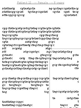 Patient 13 --– Female --– 9 years atattaatgcgccgtaatgctagccgatattagcgctagccgatattacggcgcattaatgctagccgatatatgcgctagccgatattacggcgcgccgcgatcgtaatgctacgatcggcgcatatat attacggcgcgccgcgatcgtacgatcggcgcatatat atcggcgctacgatgctacgcgattaatcggcatcgtagc atcggcgctaatatgctacgcgattaatcggcatcgtagc cggctatacgatgcatcgtatagccgtacgtata cggctatacgatcgtatagccgtacgtata tagccgcgtagctacgcgtataatcggctacg