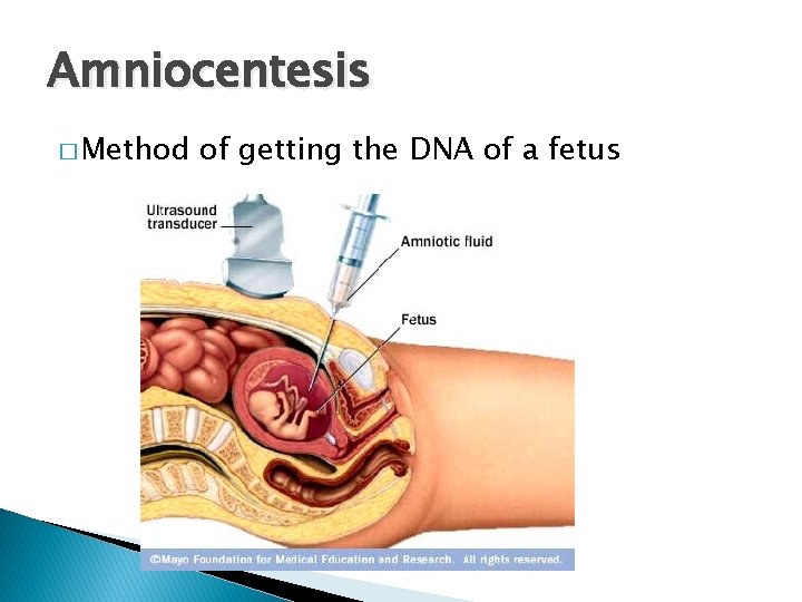 Amniocentesis � Method of getting the DNA of a fetus 