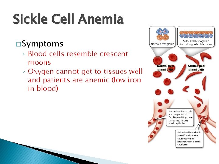 Sickle Cell Anemia � Symptoms ◦ Blood cells resemble crescent moons ◦ Oxygen cannot