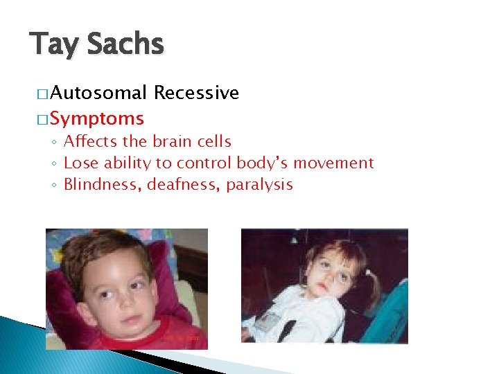 Tay Sachs � Autosomal � Symptoms Recessive ◦ Affects the brain cells ◦ Lose