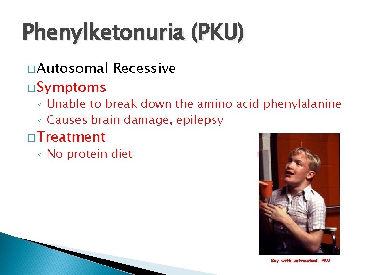 Phenylketonuria (PKU) � Autosomal � Symptoms Recessive ◦ Unable to break down the amino