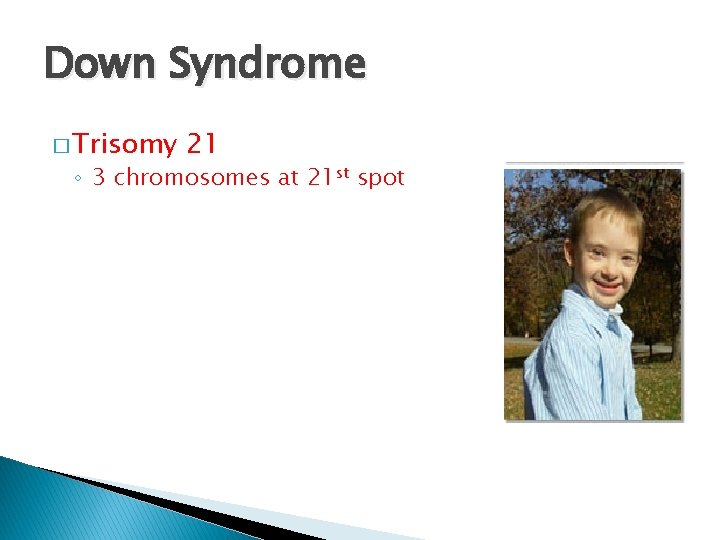 Down Syndrome � Trisomy 21 ◦ 3 chromosomes at 21 st spot 