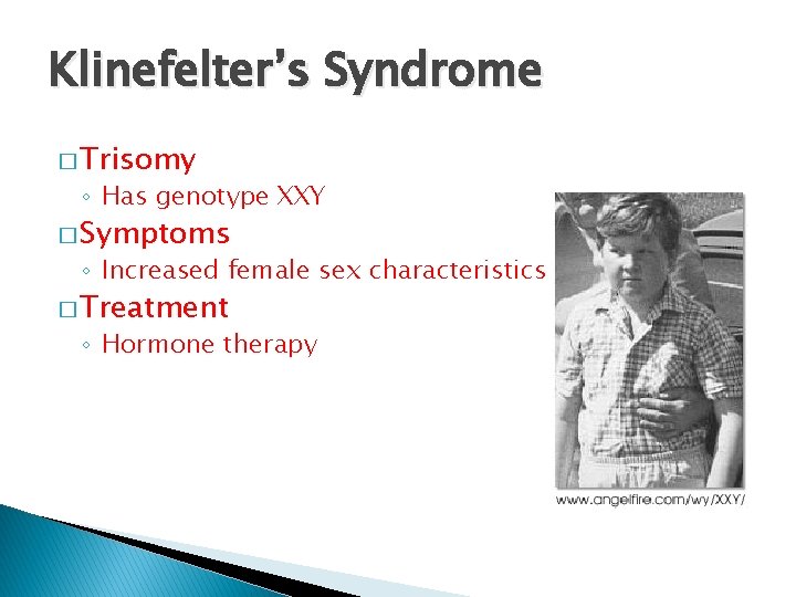 Klinefelter’s Syndrome � Trisomy ◦ Has genotype XXY � Symptoms ◦ Increased female sex