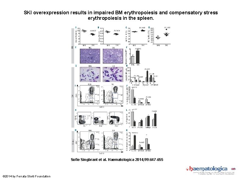 SKI overexpression results in impaired BM erythropoiesis and compensatory stress erythropoiesis in the spleen.