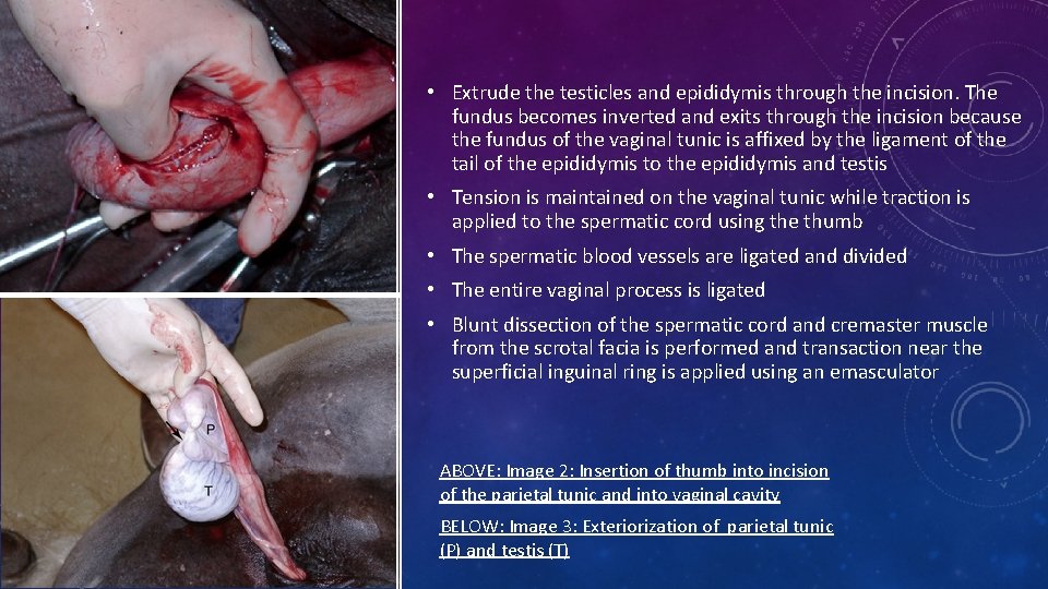  • Extrude the testicles and epididymis through the incision. The fundus becomes inverted