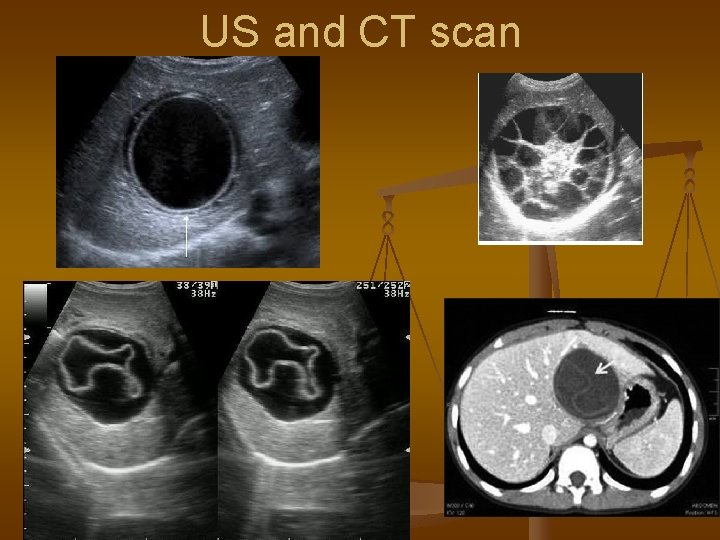 US and CT scan 