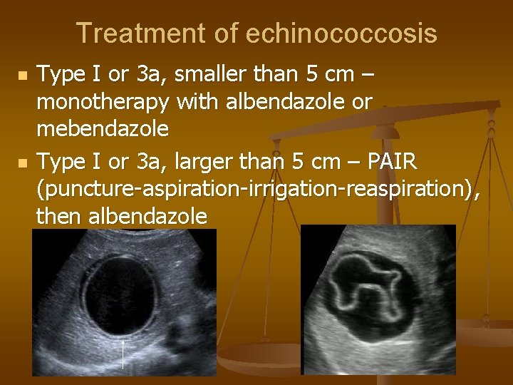 Treatment of echinococcosis n n Type I or 3 a, smaller than 5 cm
