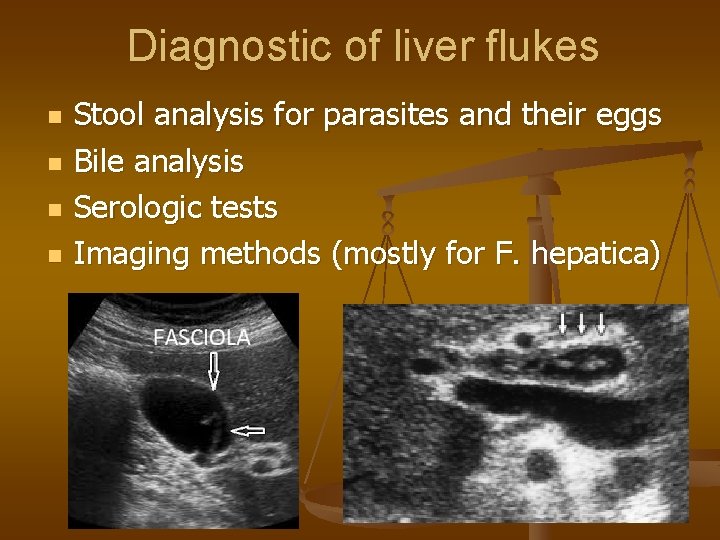 Diagnostic of liver flukes n n Stool analysis for parasites and their eggs Bile