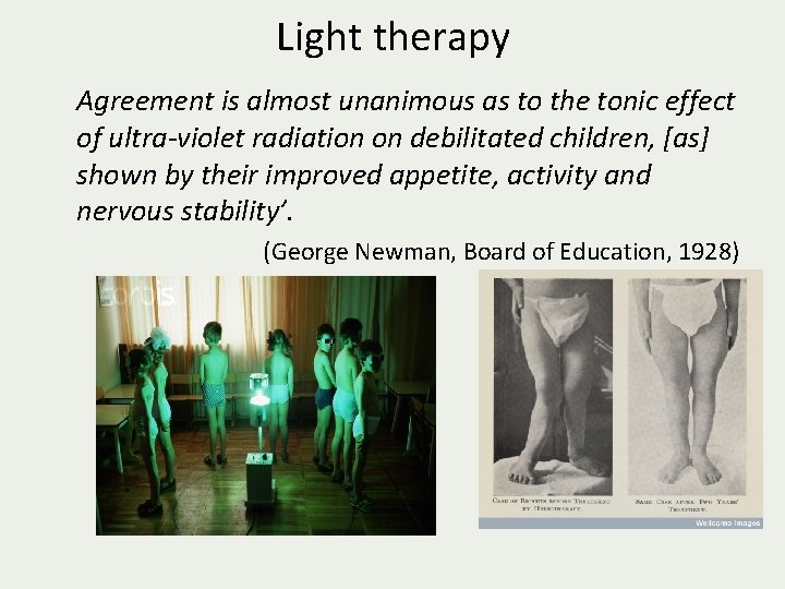 Light therapy Agreement is almost unanimous as to the tonic effect of ultra-violet radiation
