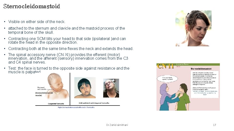 Sternocleidomastoid • Visible on either side of the neck. • attached to the sternum