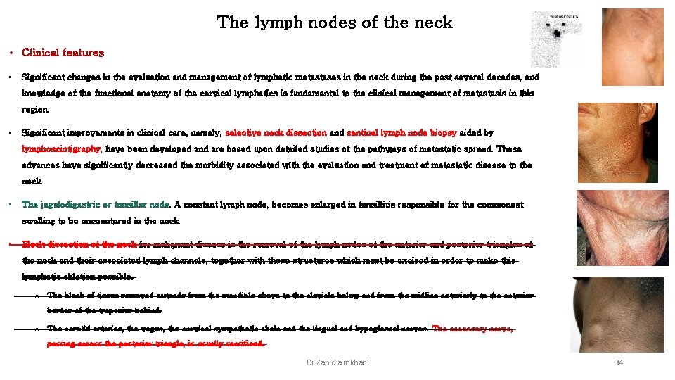 The lymph nodes of the neck • Clinical features • Significant changes in the