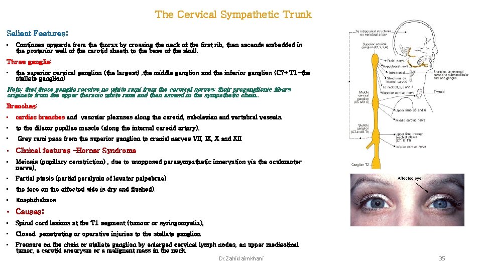 The Cervical Sympathetic Trunk Salient Features: • Continues upwards from the thorax by crossing