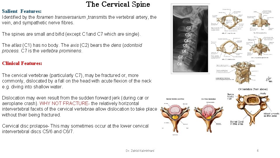 The Cervical Spine Salient Features: Identified by the foramen transversarium , transmits the vertebral