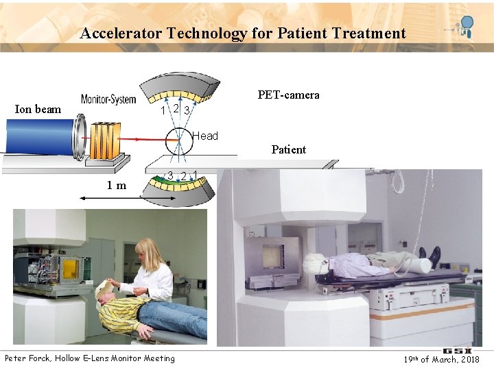 Accelerator Technology for Patient Treatment Ion beam Monitorsystem PET-camera 1 2 3 Head Patient