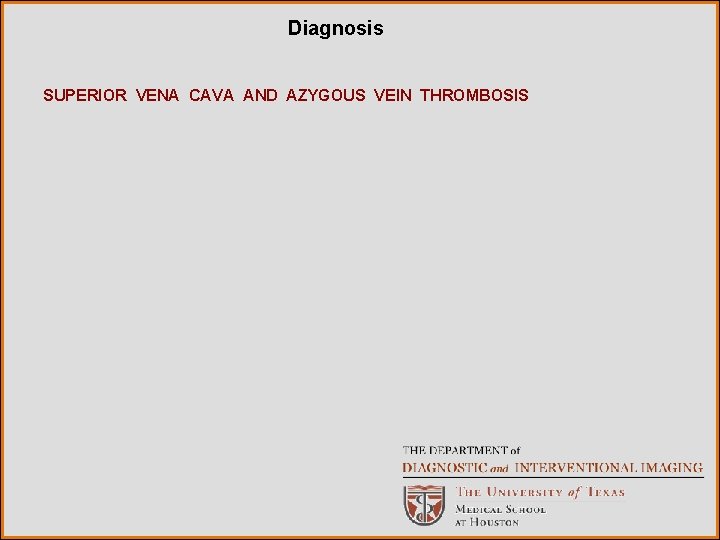 Diagnosis SUPERIOR VENA CAVA AND AZYGOUS VEIN THROMBOSIS 